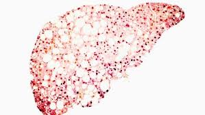 89bio: Pioneering Solutions in Biopharmaceuticals
