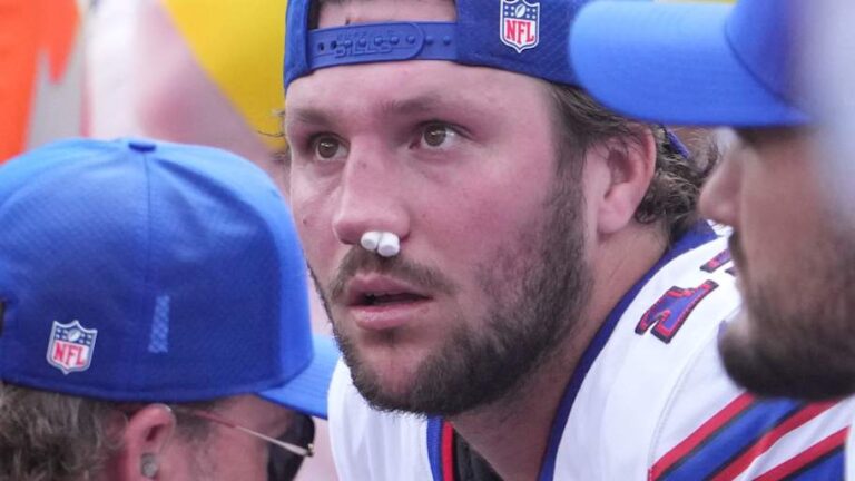 Josh Allen’s Nose Injury: What You Need to Know