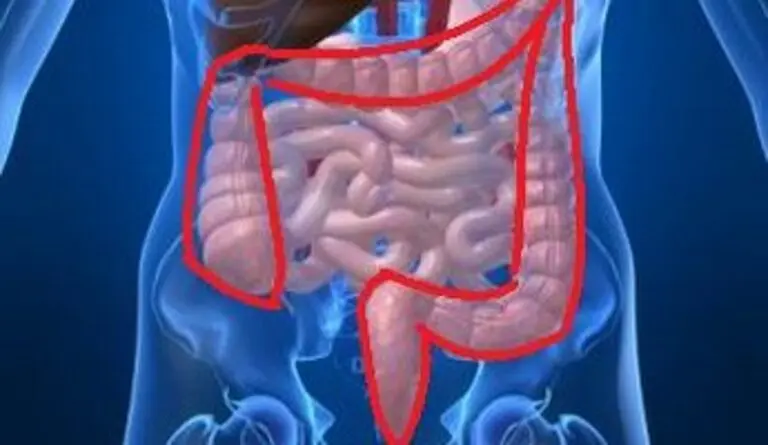 Understanding Colorectal Cancer: Risks, Symptoms, and Treatment