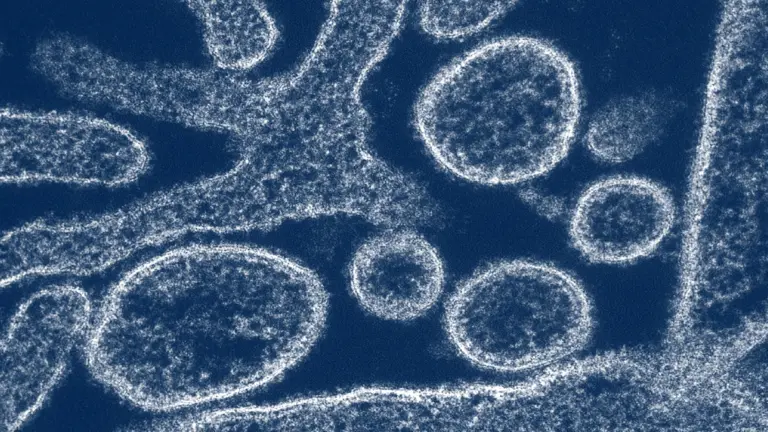 Exploring the Threat of Nipah Virus Outbreaks