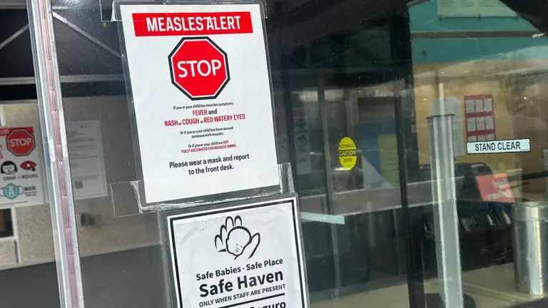 Measles Outbreak in Washington, D.C.: A Growing Concern