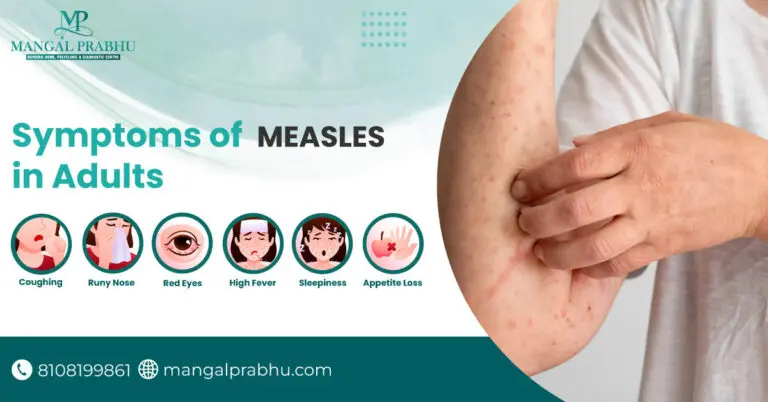 Understanding Measles Symptoms and Their Importance